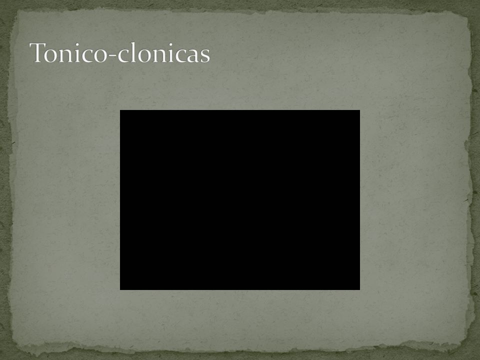 Tonico-clonicas