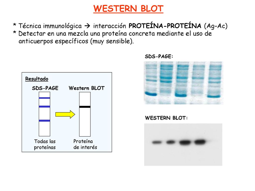 WESTERN BLOT * Técnica immunológica  interacción PROTEÍNA-PROTEÍNA (Ag-Ac) * Detectar en una mezcla una proteína concreta mediante el uso de.