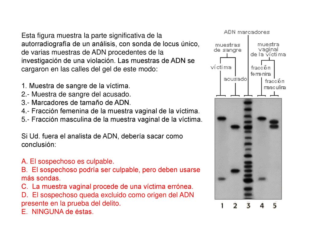 Esta figura muestra la parte significativa de la autorradiografía de un análisis, con sonda de locus único, de varias muestras de ADN procedentes de la investigación de una violación. Las muestras de ADN se cargaron en las calles del gel de este modo: