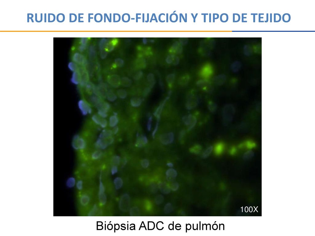 RUIDO DE FONDO-FIJACIÓN Y TIPO DE TEJIDO