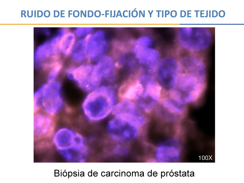 RUIDO DE FONDO-FIJACIÓN Y TIPO DE TEJIDO