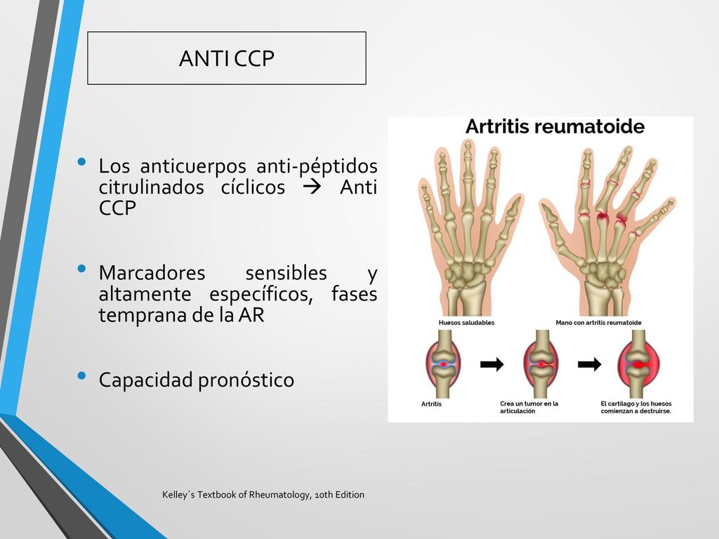 ANTI CCP Los anticuerpos anti-péptidos citrulinados cíclicos  Anti CCP. Marcadores sensibles y altamente específicos, fases temprana de la AR.