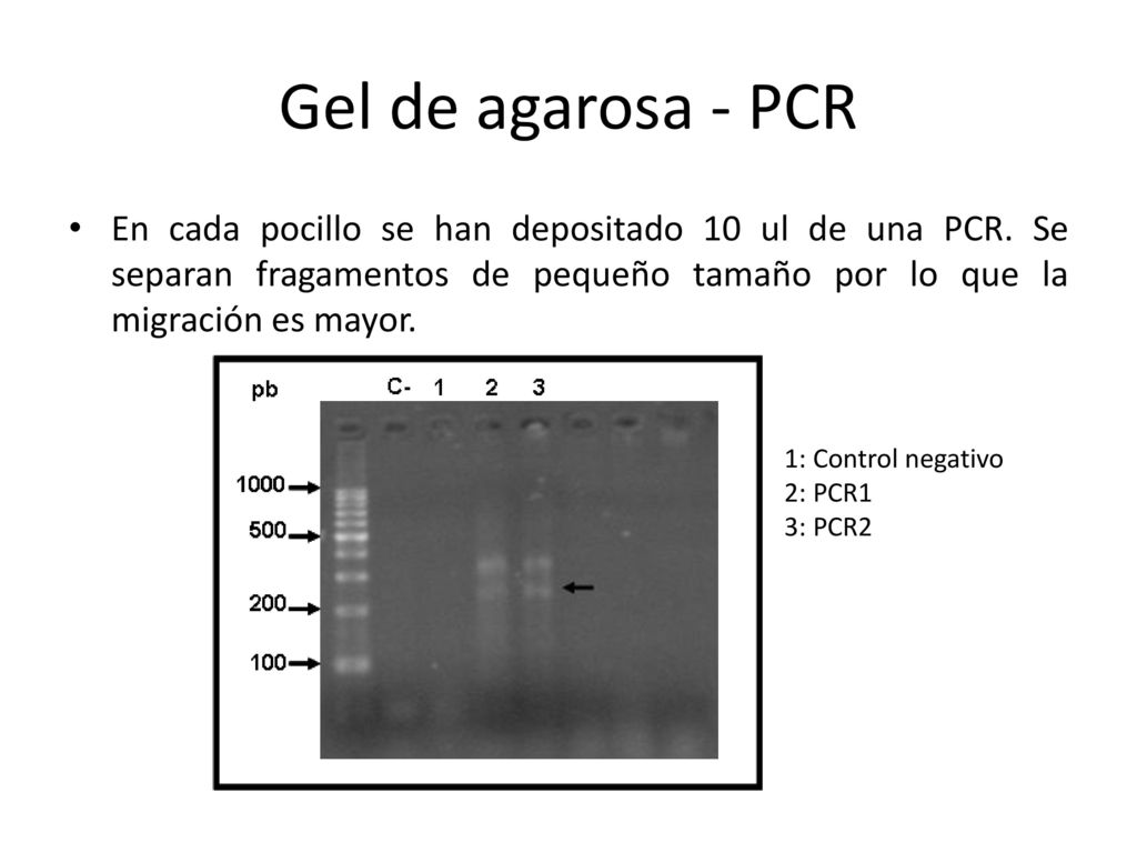 Gel de agarosa - PCR En cada pocillo se han depositado 10 ul de una PCR. Se separan fragamentos de pequeño tamaño por lo que la migración es mayor.
