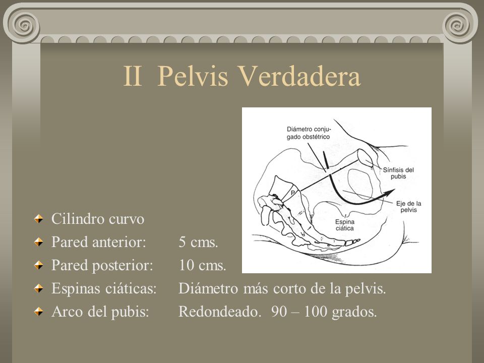 II Pelvis Verdadera Cilindro curvo Pared anterior: 5 cms.