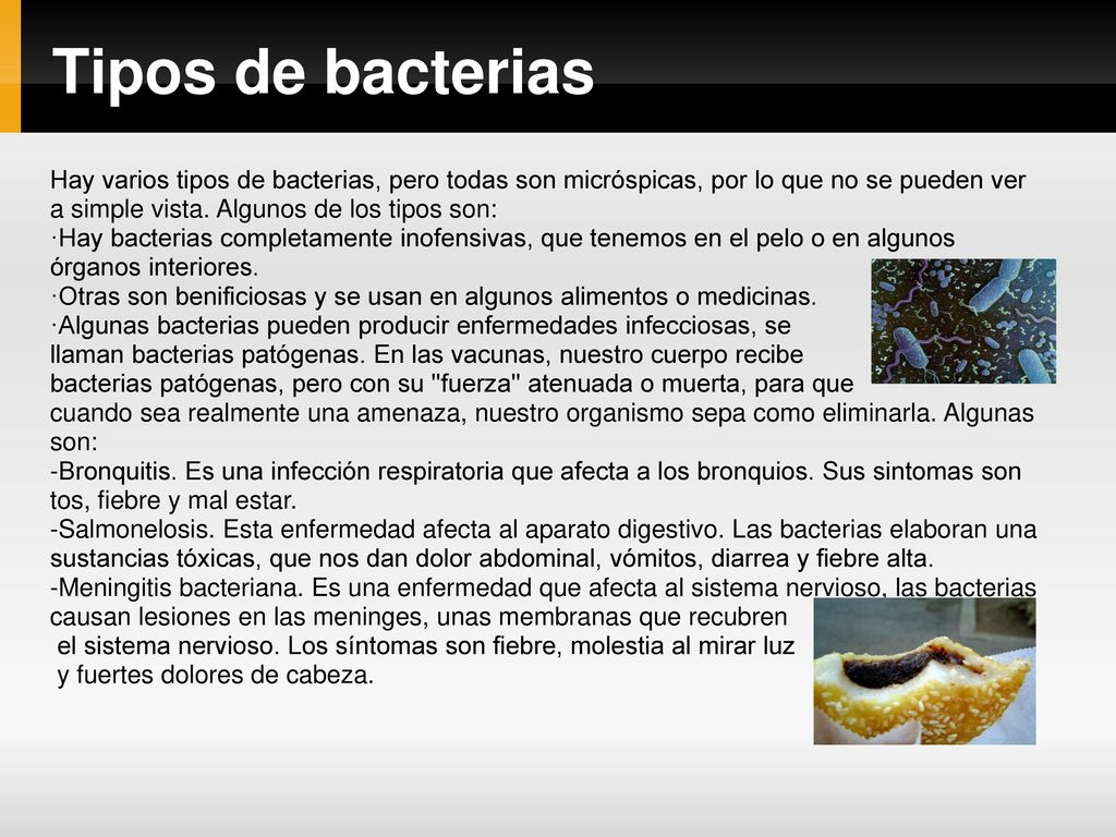 Tipos de bacterias Hay varios tipos de bacterias, pero todas son micróspicas, por lo que no se pueden ver a simple vista. Algunos de los tipos son: