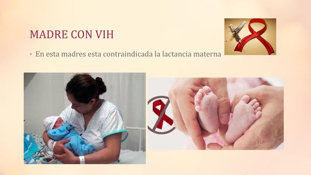 MADRE CON VIH En esta madres esta contraindicada la lactancia materna