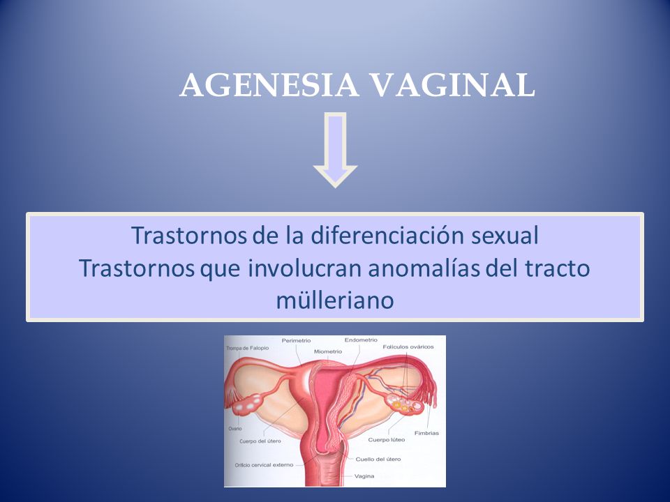 AGENESIA VAGINAL Trastornos de la diferenciación sexual Trastornos que involucran anomalías del tracto mülleriano.