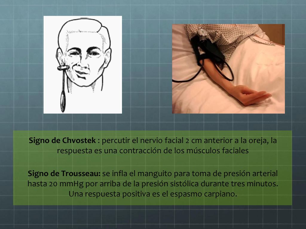 Signo de Chvostek : percutir el nervio facial 2 cm anterior a la oreja, la respuesta es una contracción de los músculos faciales