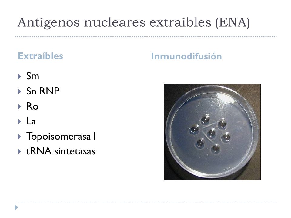 Antígenos nucleares extraíbles (ENA)