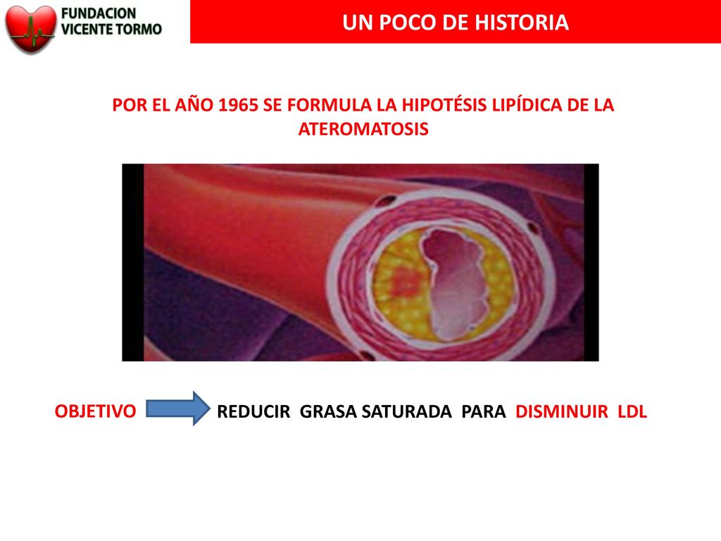 POR EL AÑO 1965 SE FORMULA LA HIPOTÉSIS LIPÍDICA DE LA ATEROMATOSIS