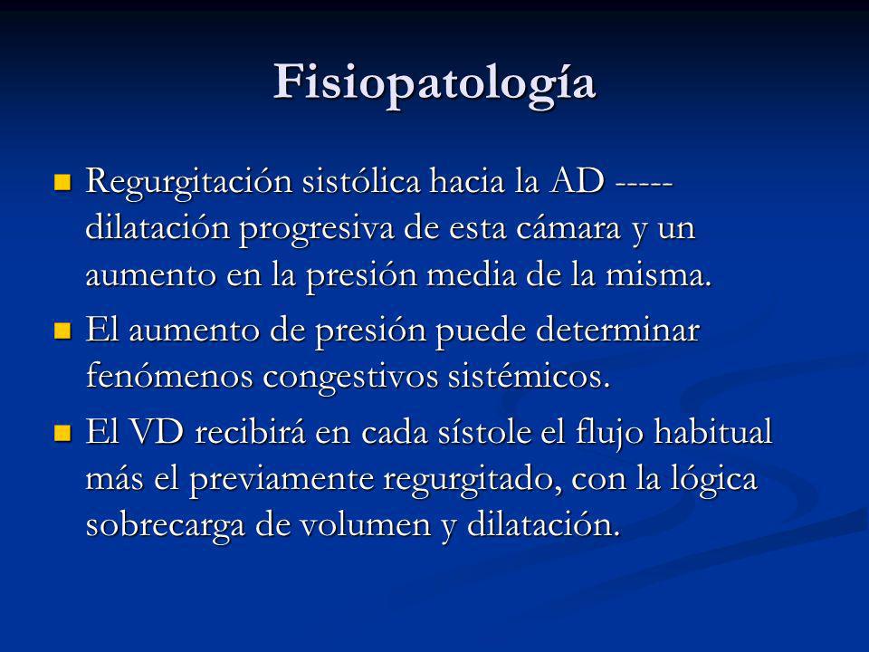 Fisiopatología Regurgitación sistólica hacia la AD dilatación progresiva de esta cámara y un aumento en la presión media de la misma.