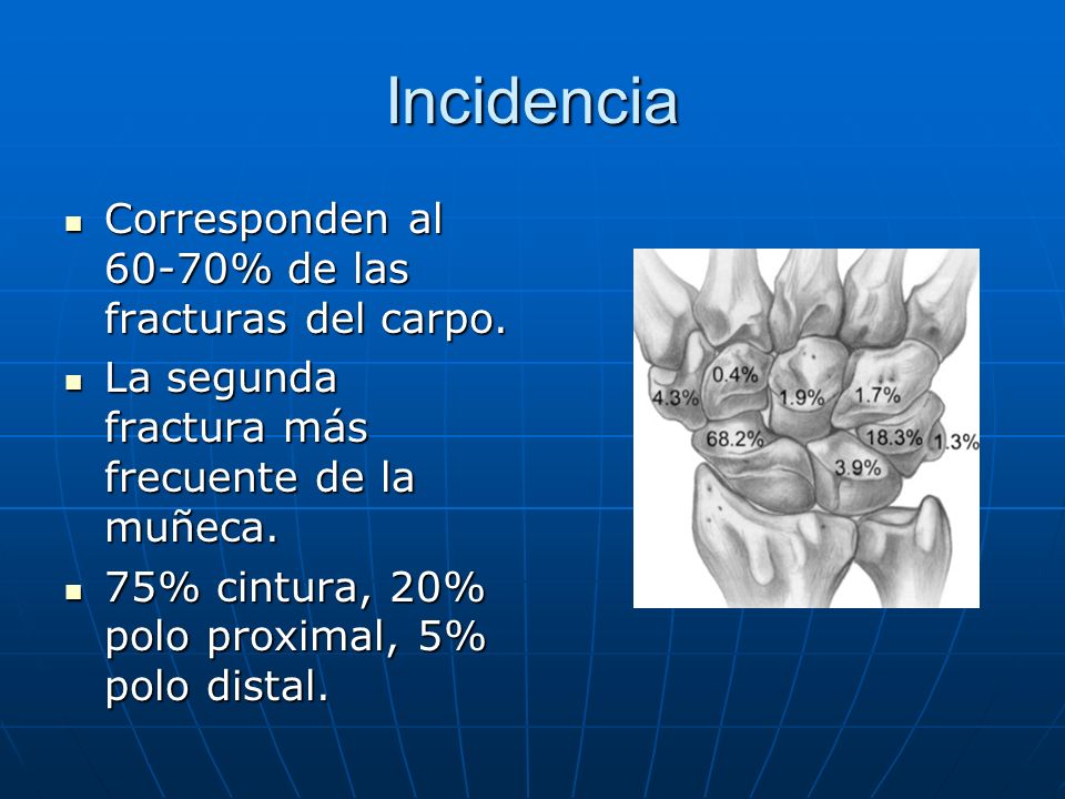 Incidencia Corresponden al 60-70% de las fracturas del carpo.