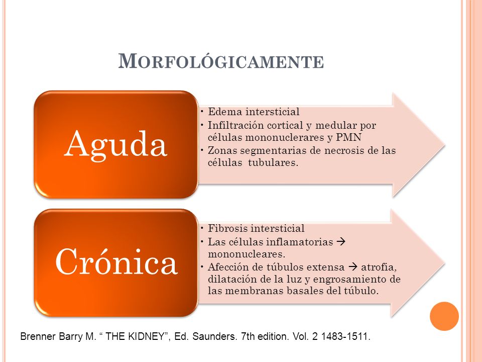 Morfológicamente Aguda. Edema intersticial. Infiltración cortical y medular por células mononuclerares y PMN.