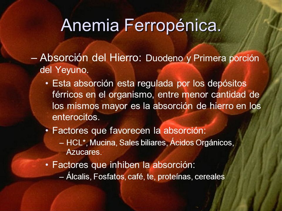 Anemia Ferropénica. Absorción del Hierro: Duodeno y Primera porción del Yeyuno.