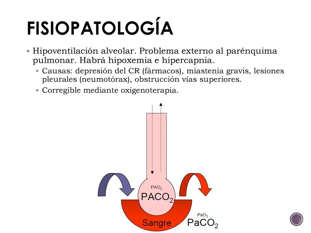 FISIOPATOLOGÍA Hipoventilación alveolar. Problema externo al parénquima pulmonar. Habrá hipoxemia e hipercapnia.