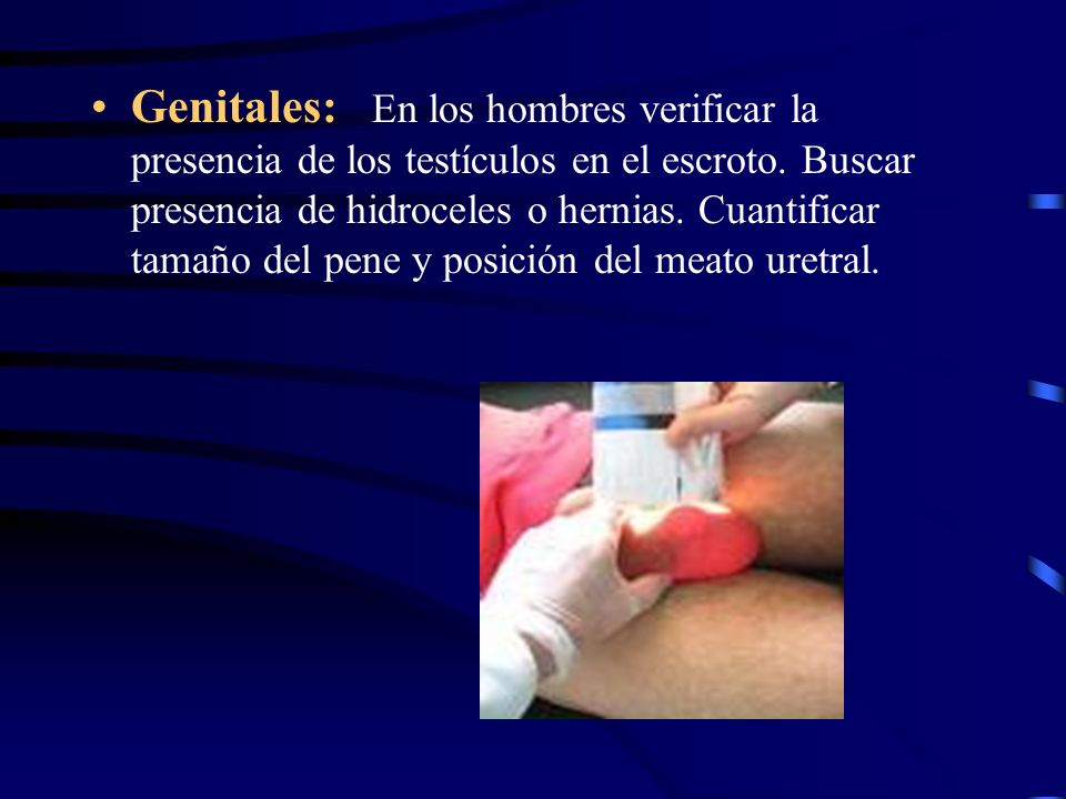 Genitales: En los hombres verificar la presencia de los testículos en el escroto.
