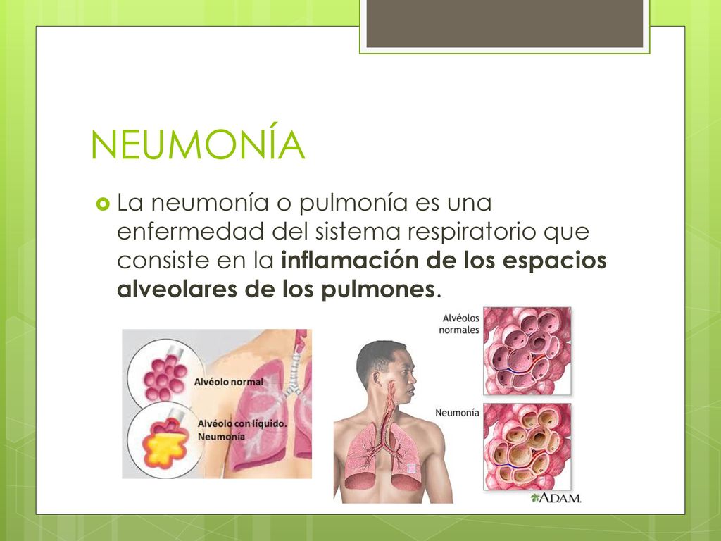 NEUMONÍA La neumonía o pulmonía es una enfermedad del sistema respiratorio que consiste en la inflamación de los espacios alveolares de los pulmones.