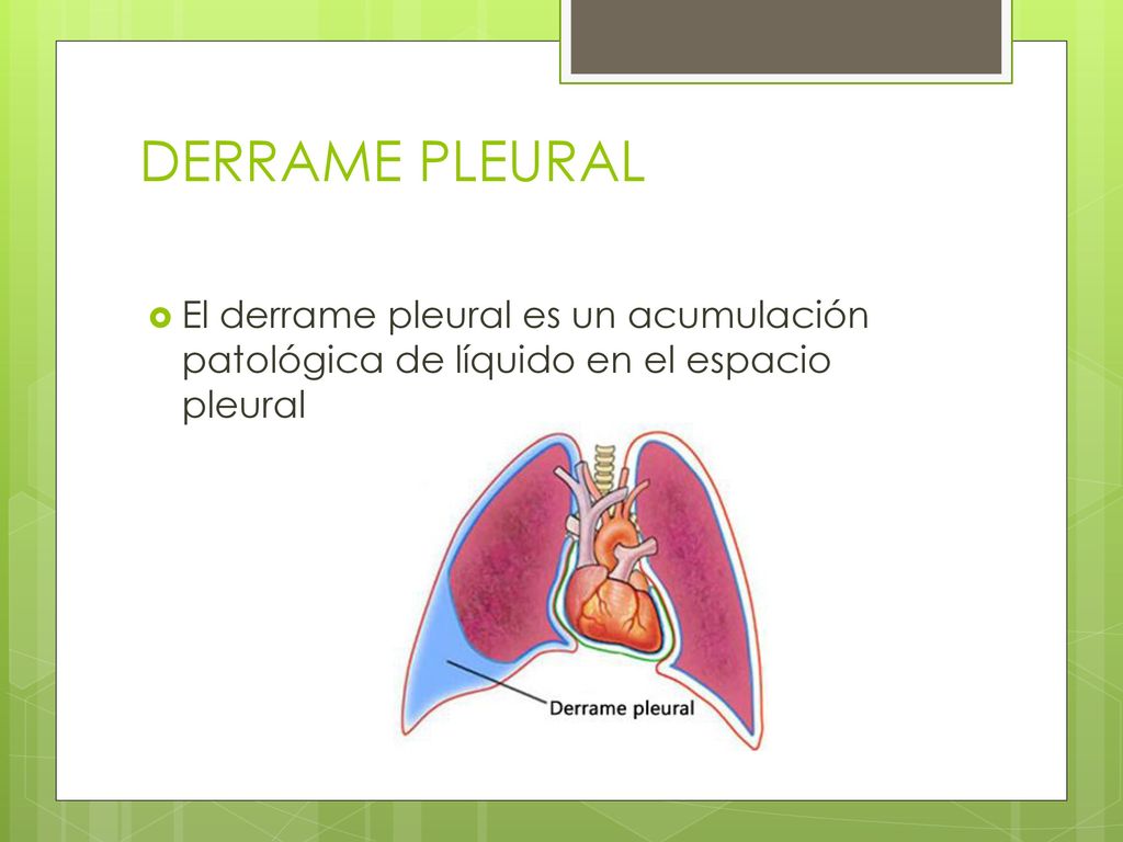 DERRAME PLEURAL El derrame pleural es un acumulación patológica de líquido en el espacio pleural