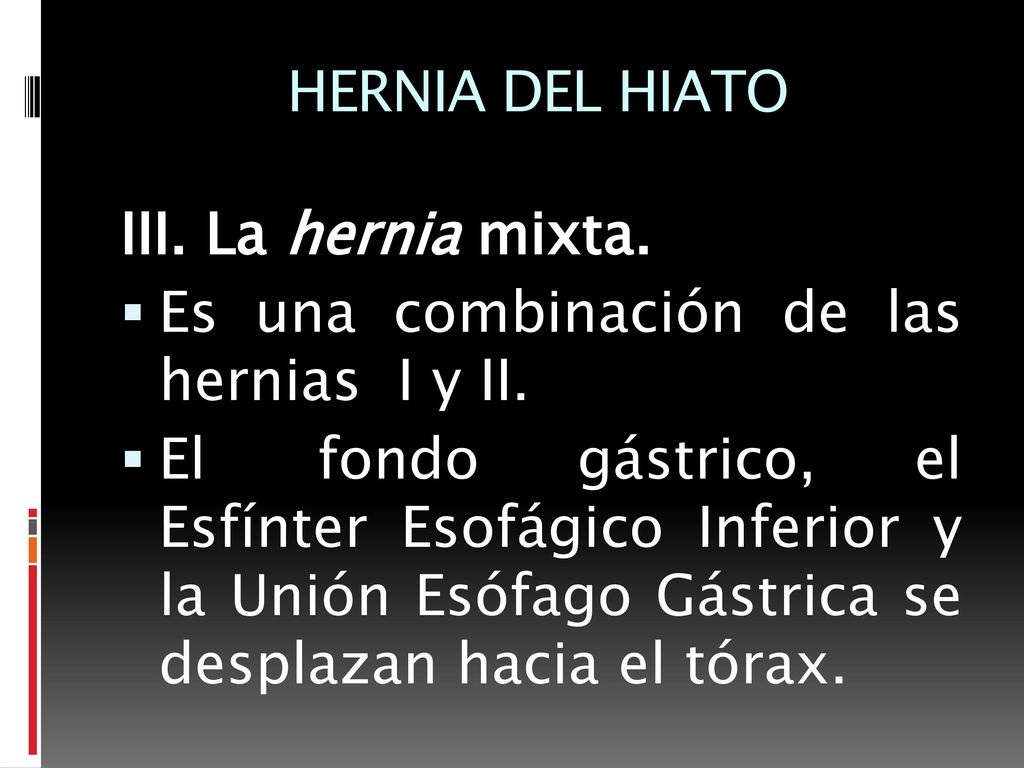 HERNIA DEL HIATO III. La hernia mixta. Es una combinación de las hernias I y II.