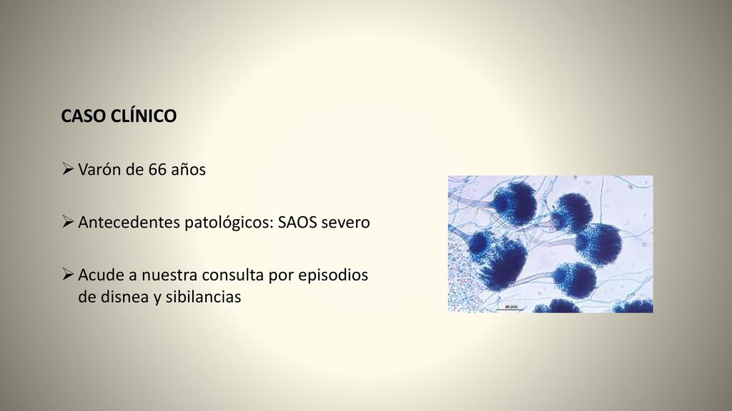 CASO CLÍNICO Varón de 66 años Antecedentes patológicos: SAOS severo