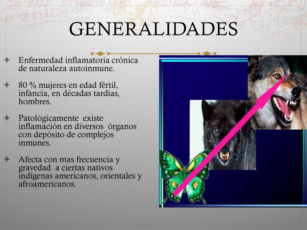 GENERALIDADES Enfermedad inflamatoria crónica de naturaleza autoinmune. 80 % mujeres en edad fértil, infancia, en décadas tardías, hombres.