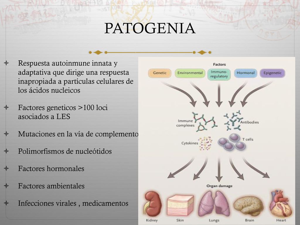 PATOGENIA Respuesta autoinmune innata y adaptativa que dirige una respuesta inapropiada a partículas celulares de los ácidos nucleicos.