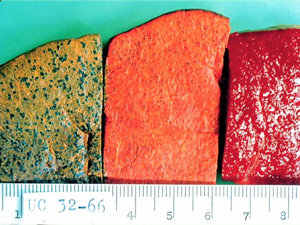 Tres cortes de bazo de sagú (257 g)
