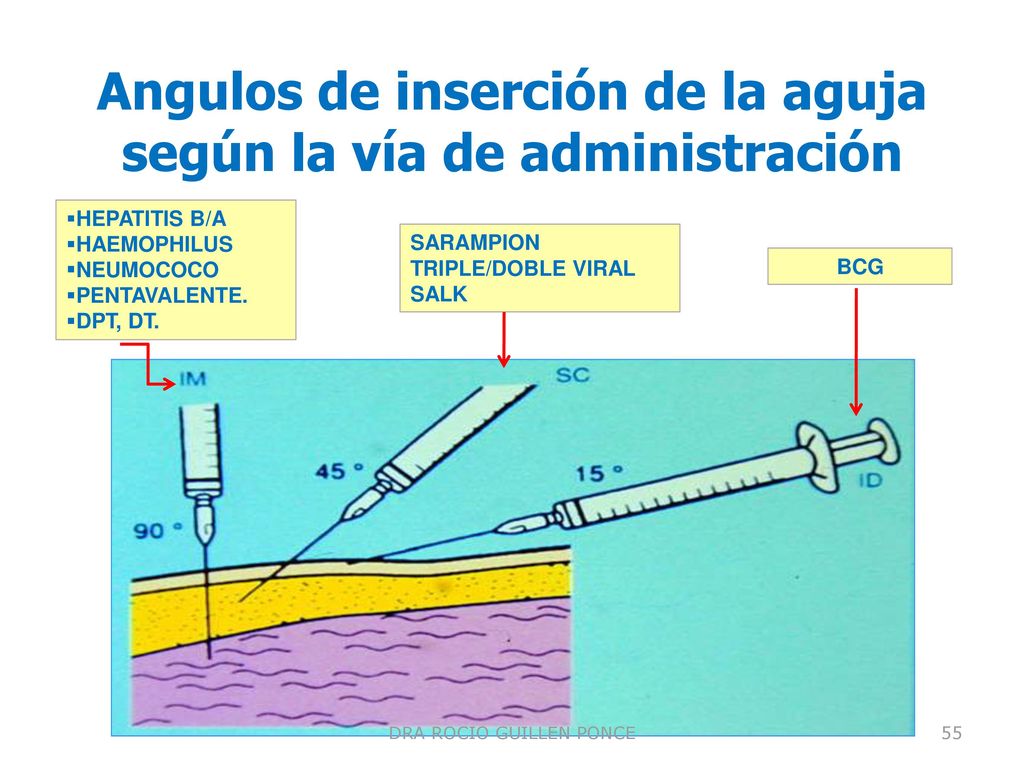 Angulos de inserción de la aguja según la vía de administración