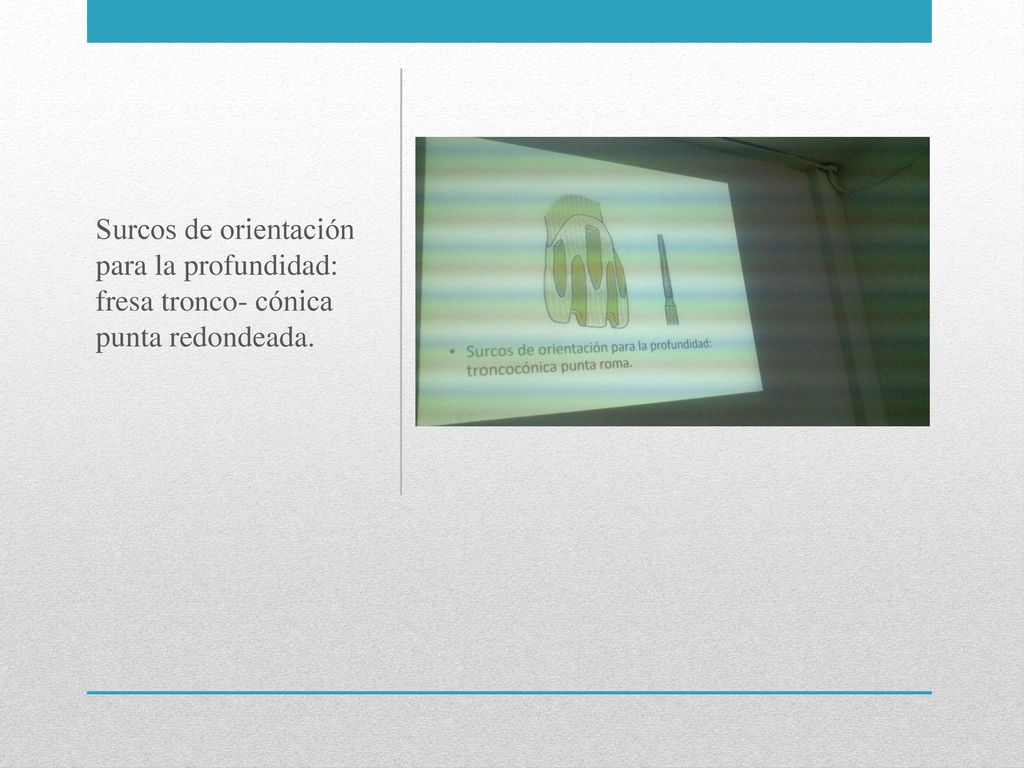 Surcos de orientación para la profundidad: fresa tronco- cónica punta redondeada.