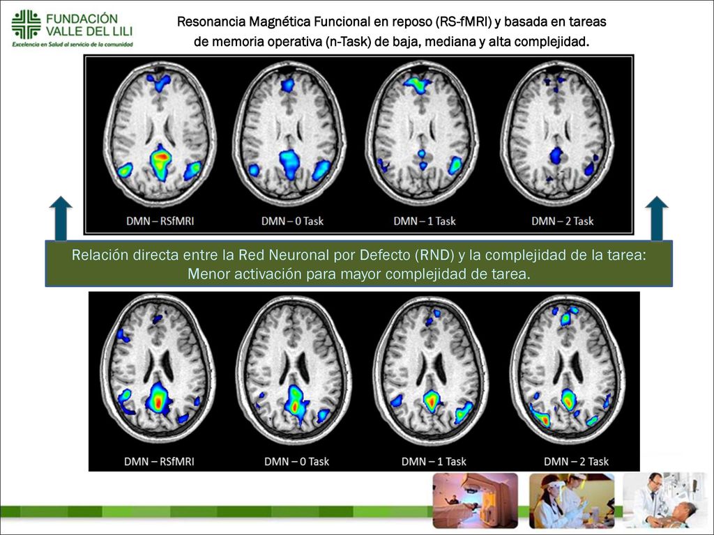 Resonancia Magnética Funcional en reposo (RS-fMRI) y basada en tareas