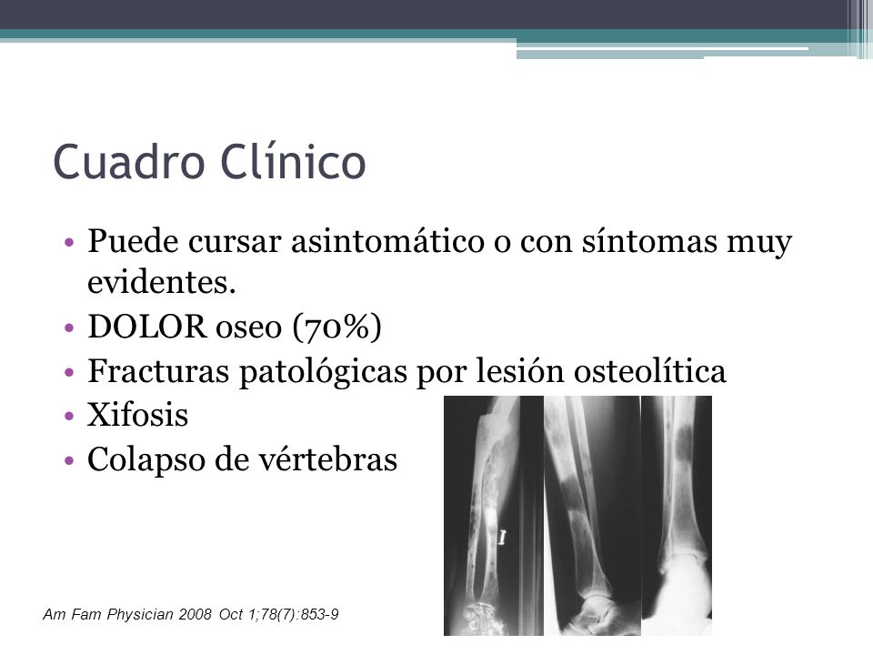 Cuadro Clínico Puede cursar asintomático o con síntomas muy evidentes.