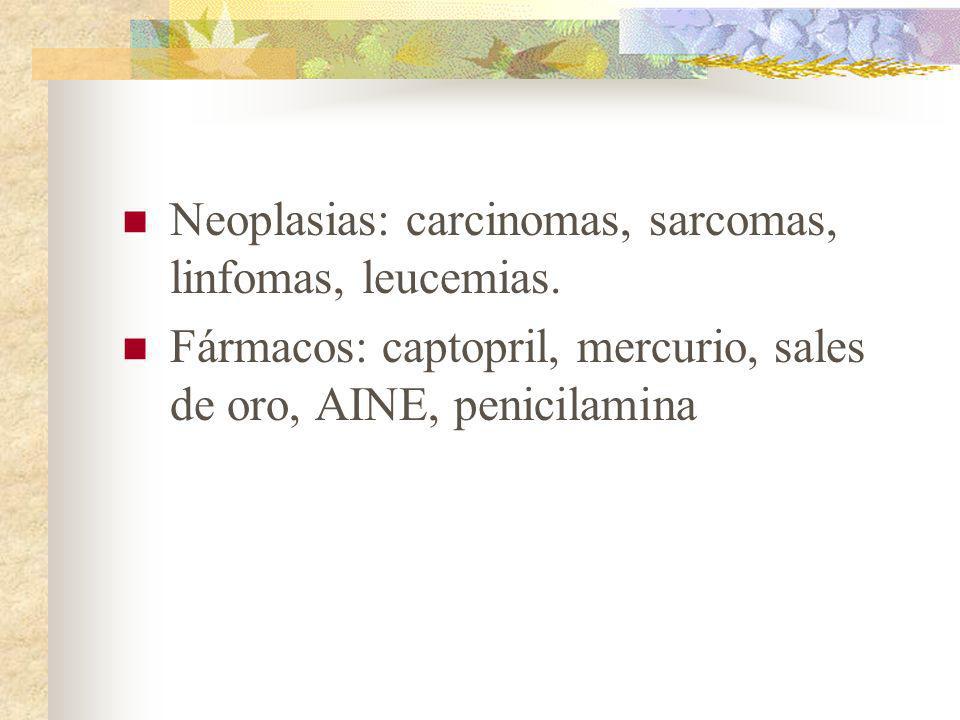 Neoplasias: carcinomas, sarcomas, linfomas, leucemias.