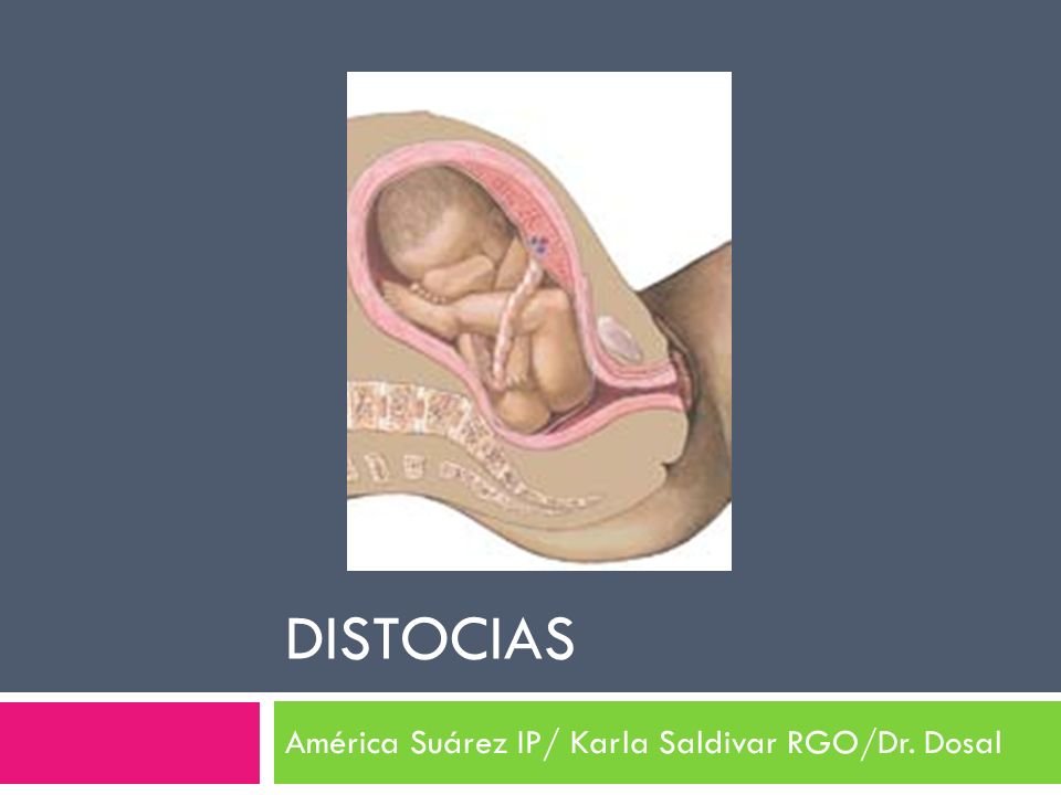 América Suárez IP/ Karla Saldivar RGO/Dr. Dosal