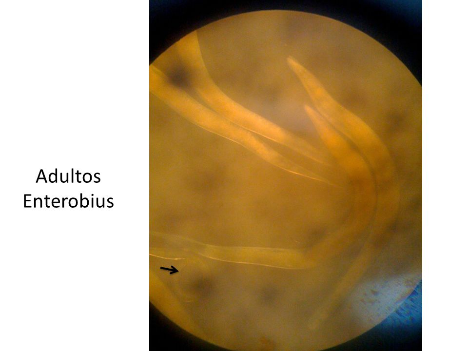 Adultos Enterobius Flecha: Parece estar señalando la cola de un macho.