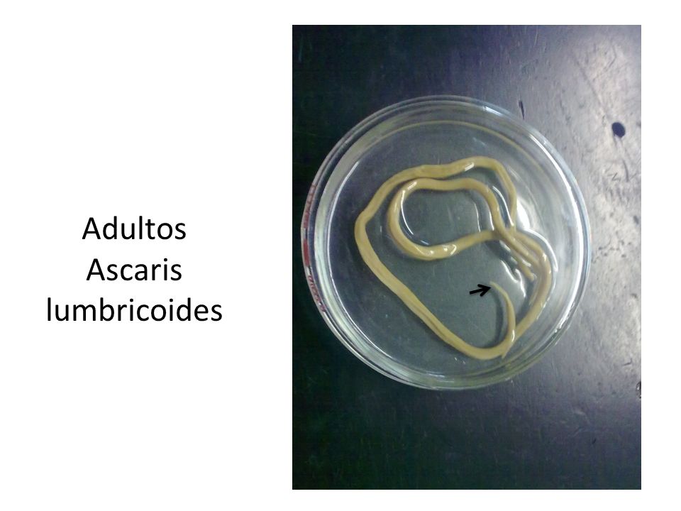 Adultos Ascaris lumbricoides