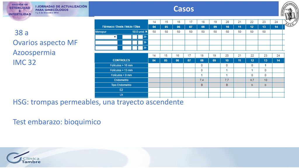Casos 38 a Ovarios aspecto MF Azoospermia IMC 32 HSG: trompas permeables, una trayecto ascendente Test embarazo: bioquimico