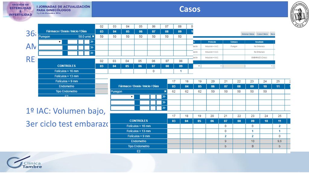 Casos 36a AMH 3,2 REM 24 M 1º IAC: Volumen bajo, Leucos.