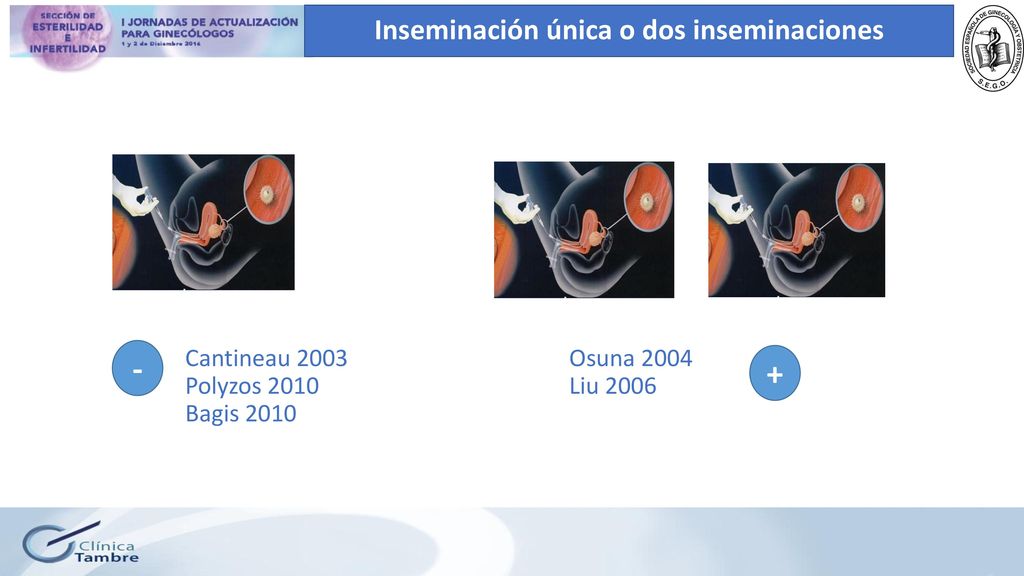 Cantineau 2003 Osuna 2004 Polyzos 2010 Liu 2006 Bagis 2010