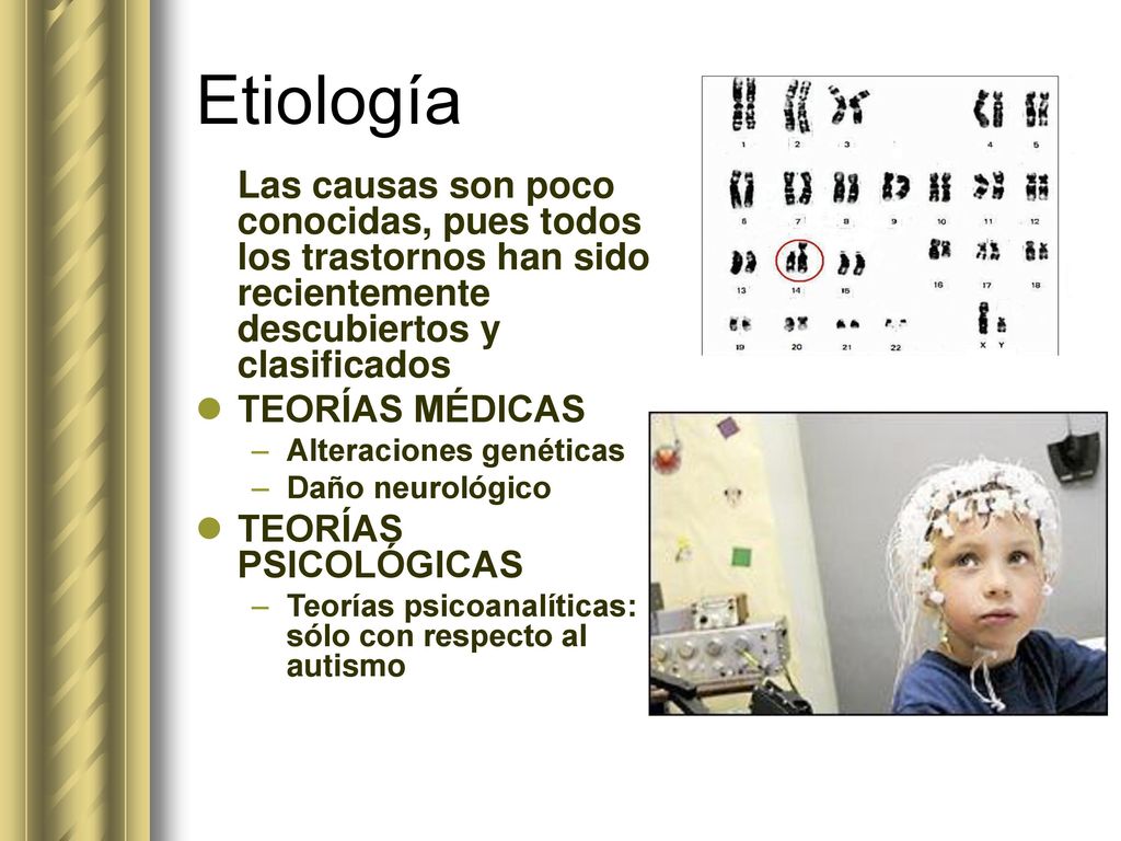 Etiología Las causas son poco conocidas, pues todos los trastornos han sido recientemente descubiertos y clasificados.