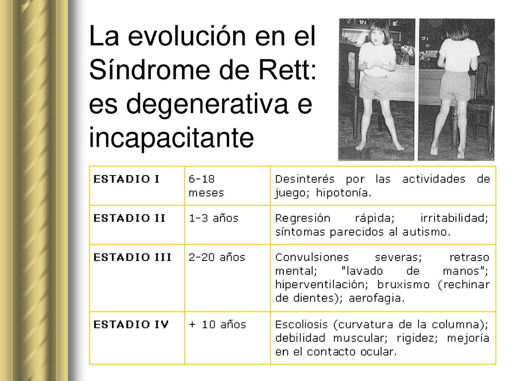 La evolución en el Síndrome de Rett: es degenerativa e incapacitante
