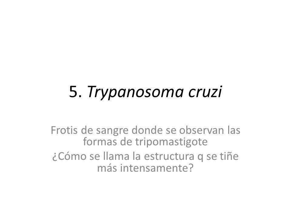 5. Trypanosoma cruzi Frotis de sangre donde se observan las formas de tripomastigote.