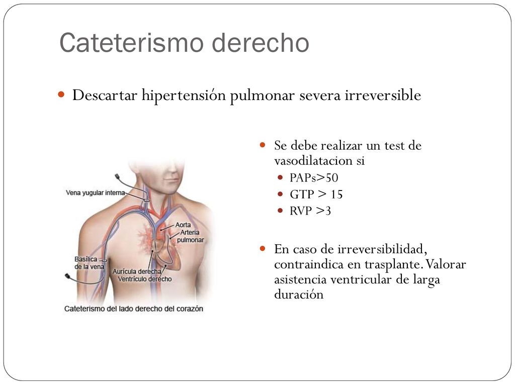Cateterismo derecho Descartar hipertensión pulmonar severa irreversible. Se debe realizar un test de vasodilatacion si.