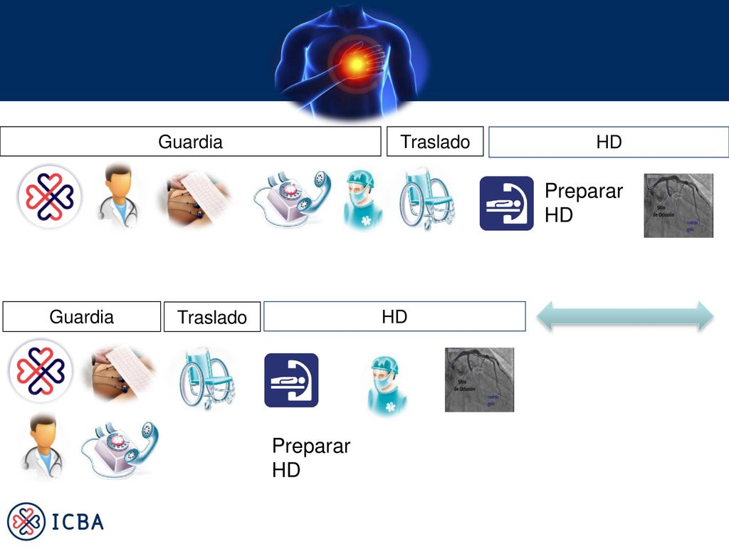 Guardia Traslado HD Preparar HD Guardia Traslado HD Preparar HD
