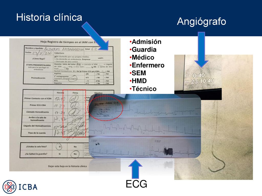 Historia clínica Angiógrafo ECG Admisión Guardia Médico Enfermero SEM