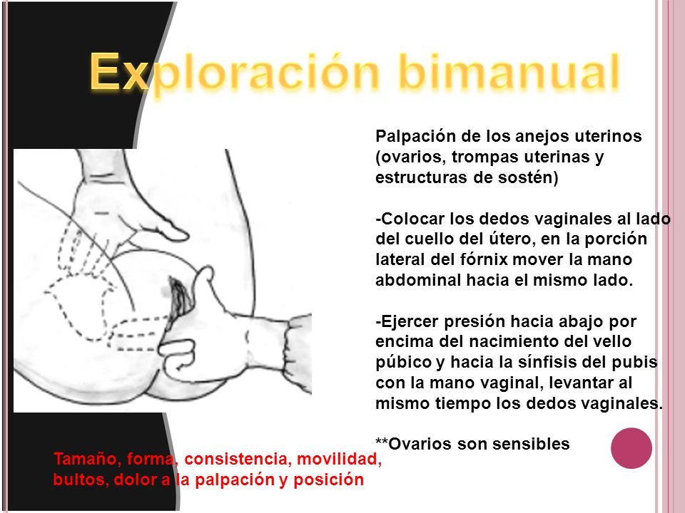 Exploración bimanual Palpación de los anejos uterinos (ovarios, trompas uterinas y estructuras de sostén)