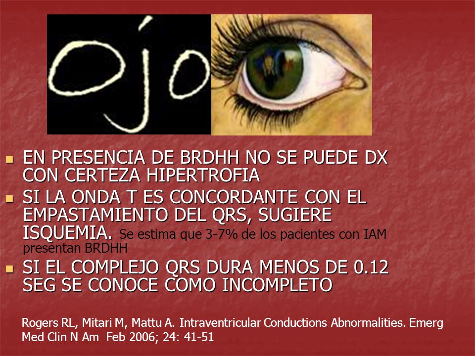 EN PRESENCIA DE BRDHH NO SE PUEDE DX CON CERTEZA HIPERTROFIA