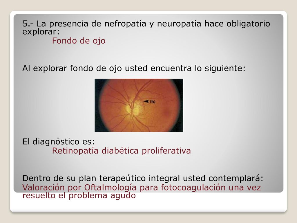 5.- La presencia de nefropatía y neuropatía hace obligatorio explorar: Fondo de ojo Al explorar fondo de ojo usted encuentra lo siguiente: El diagnóstico es: Retinopatía diabética proliferativa Dentro de su plan terapeútico integral usted contemplará: Valoración por Oftalmología para fotocoagulación una vez resuelto el problema agudo