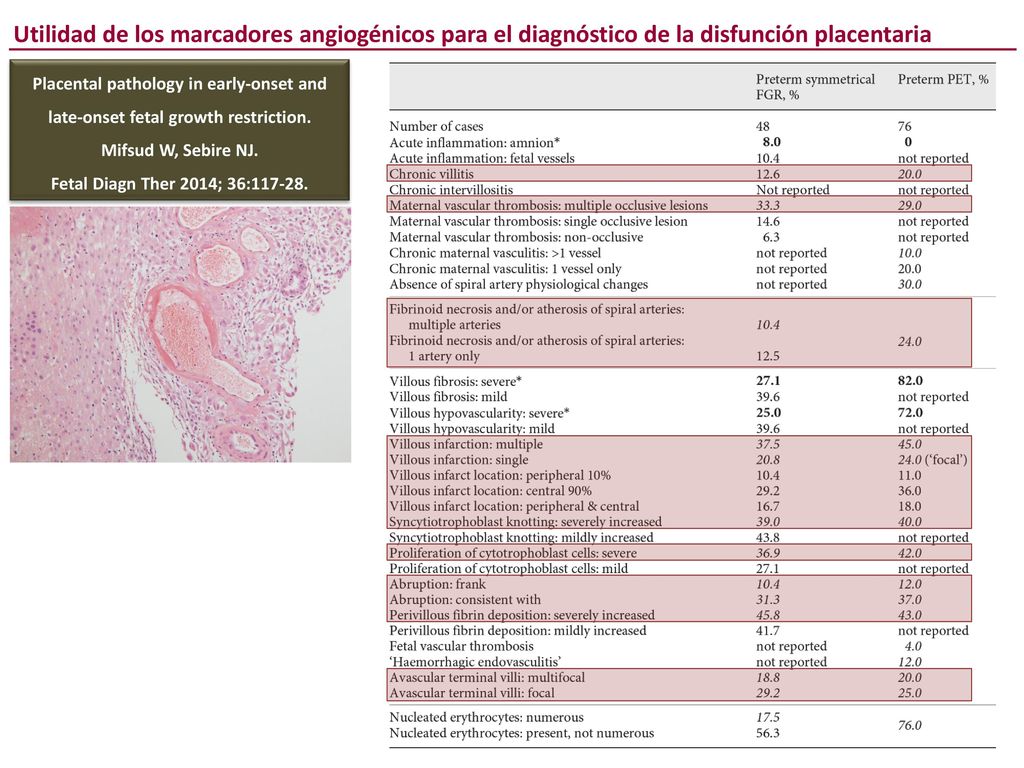 Utilidad de los marcadores angiogénicos para el diagnóstico de la disfunción placentaria