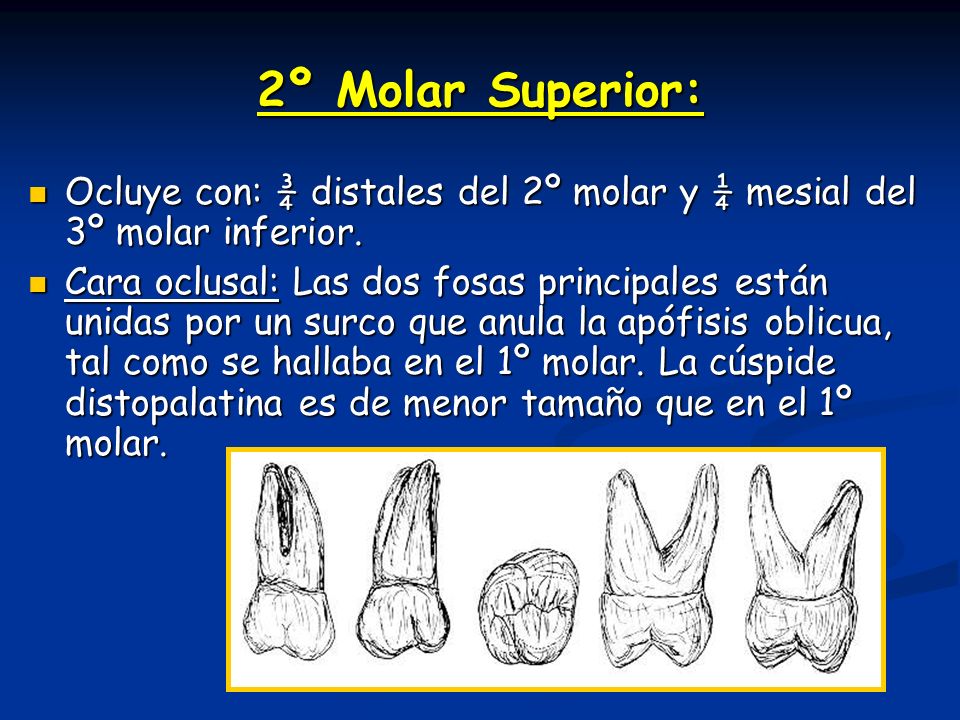 2º Molar Superior: Ocluye con: ¾ distales del 2º molar y ¼ mesial del 3º molar inferior.
