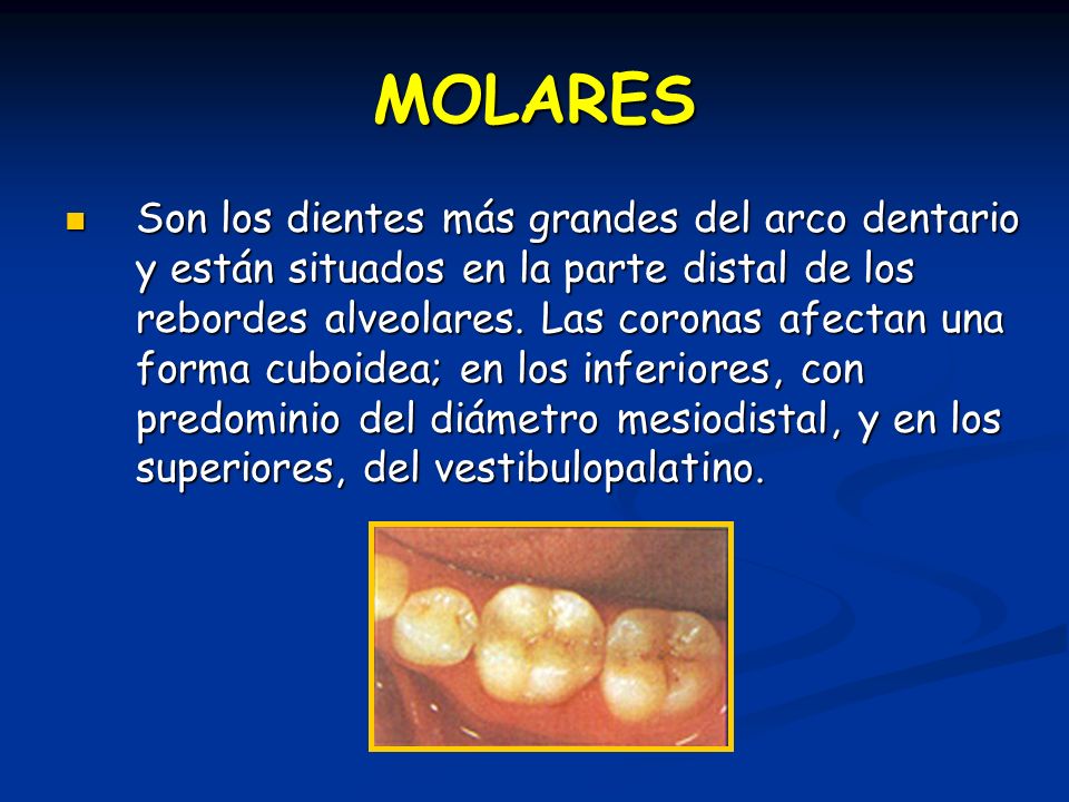 MOLARES